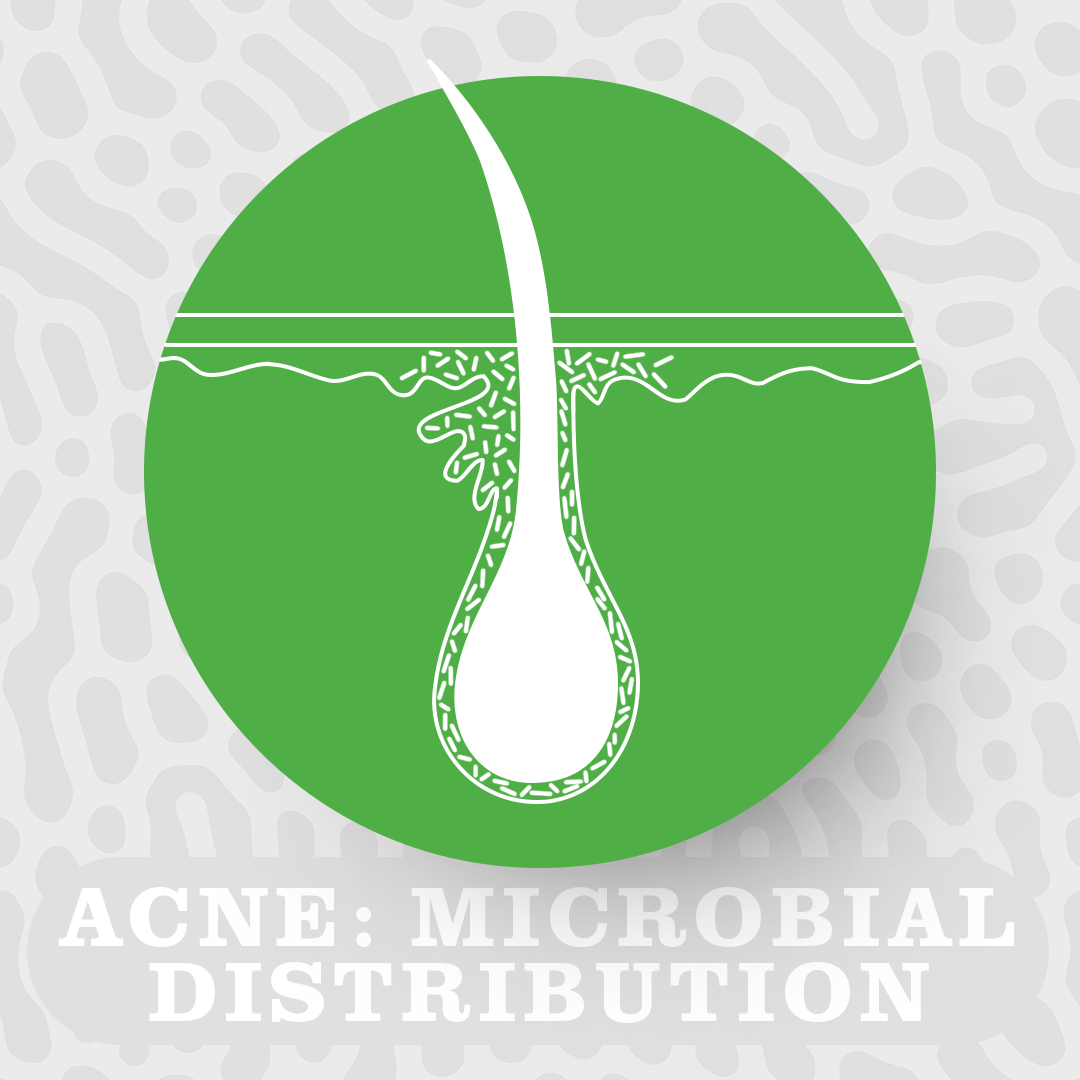 Acne microbial distribution 