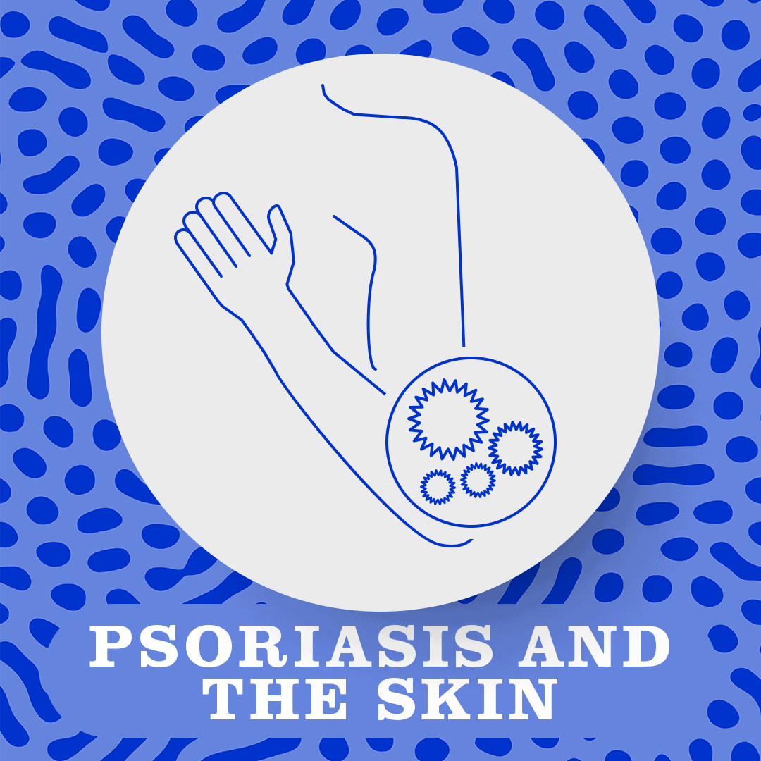 psoriasis and the skin